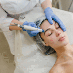 Microneedling In Cambridge For Long Term Skin Renewal