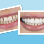 Dental Results
