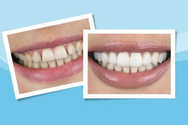 Dental Results