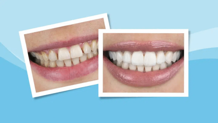 Dental Results